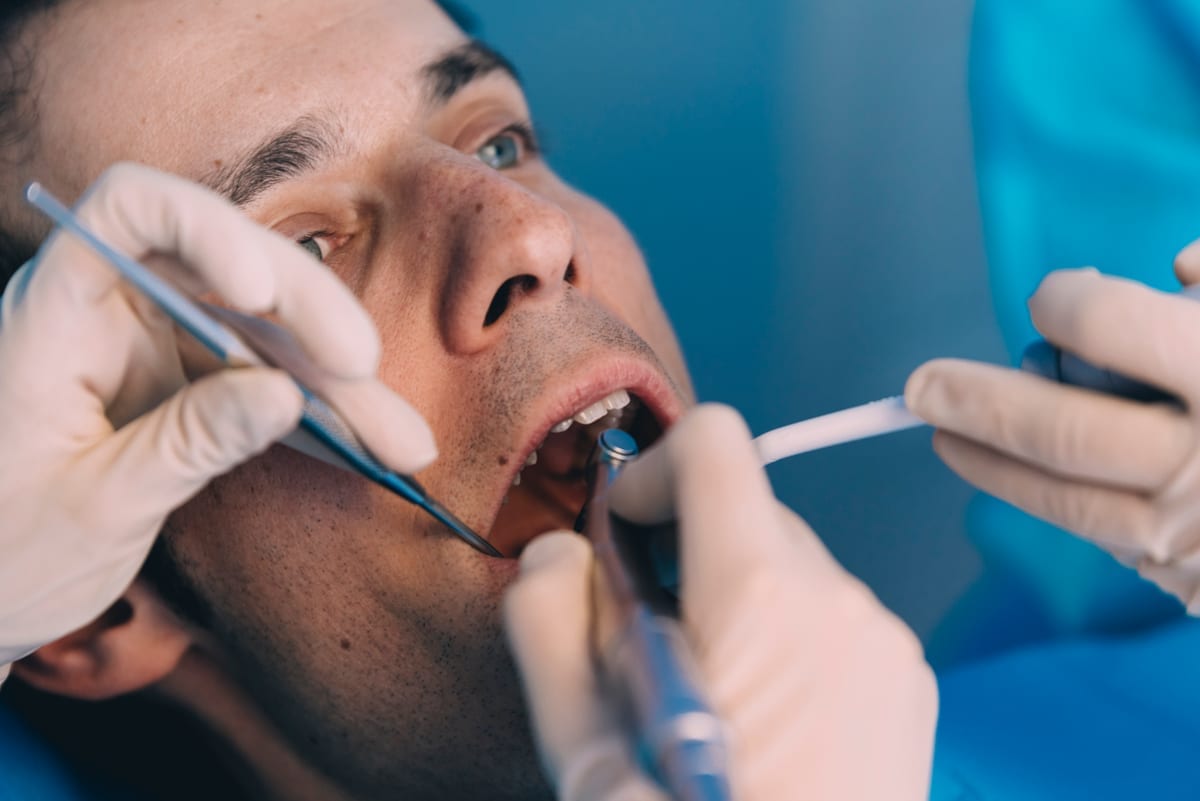 Root Canal Treatment in Chicago